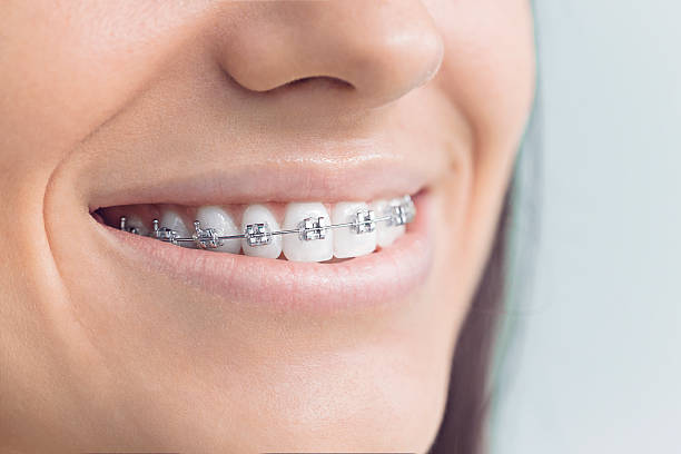 Best Veneers and Lumineers  in Hot Springs, SD